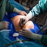 Polscy ginekolodzy będą operować kobiety w jednym z najuboższych krajów świata