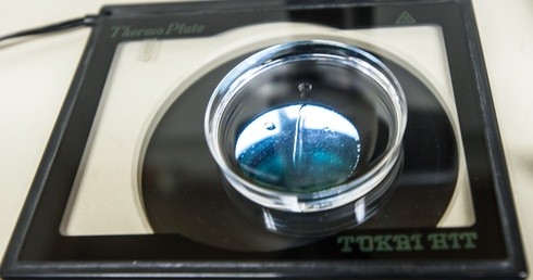 In vitro z miejskiej kasy