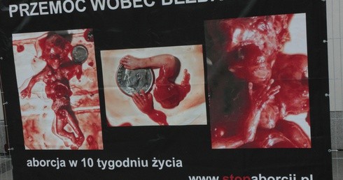 Sąd uniewinnił działacza pro life