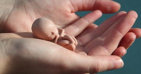 "Zdjęcia ciał dzieci poddanych aborcji pokazują prawdę, ale cel nie uświęca środków"